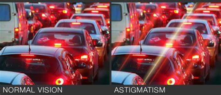 Is astigmatism 0 25 bad